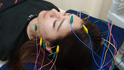 Sky Blue Acupuncture Orthopedic Clinic 사진 2