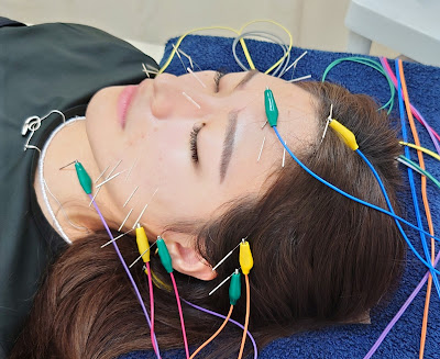 Sky Blue Acupuncture Orthopedic Clinic 사진 5