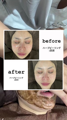 Harumi美容整体 池袋店 사진 2