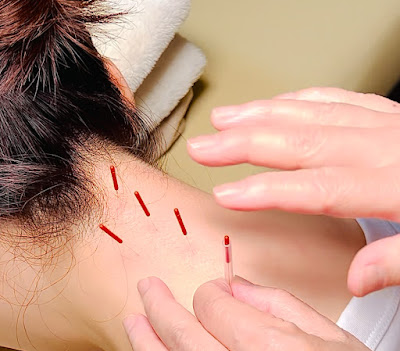 Elle Acupuncture Therapy Ikebukuro 사진 3