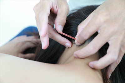 Suzuki Acupuncture Orthopedic Clinic 사진 4
