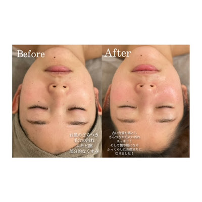 inori facial・bodycare 사진 3