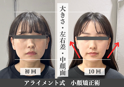 整体 Alignment 恵比寿 사진 5