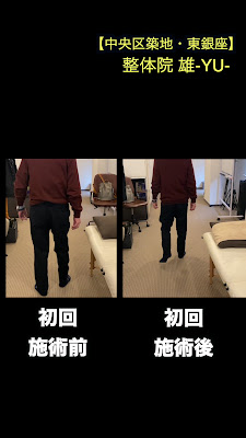 YU 사진 2