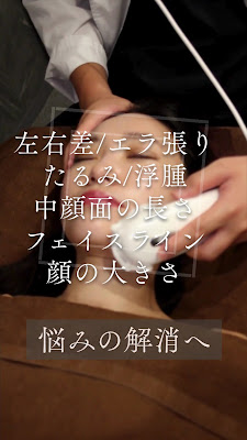 至高のリフトアップ& 사진 2