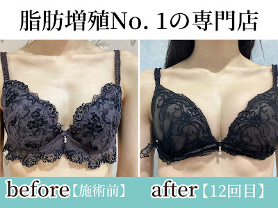 バストのお悩みは育乳バスト専門店 サラエクセレント 銀座【SARAEXCELLENT】バストアップ 사진 4