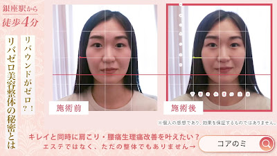 GINZA美容整体コアのミ 사진 2