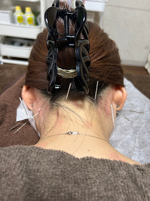 clear Acupuncture 사진 4