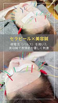 ホジュン鍼灸整体院허준침술원 도쿄한의원 우에노한의원 사진 2