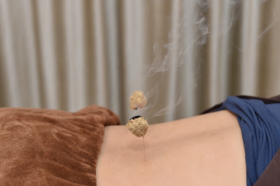 Kigawaueno Acupuncture 사진 3
