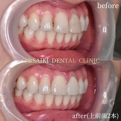 白金SAIKI DENTAL CLINIC(白金高輪駅1番出口徒歩1分の歯医者) 사진 4