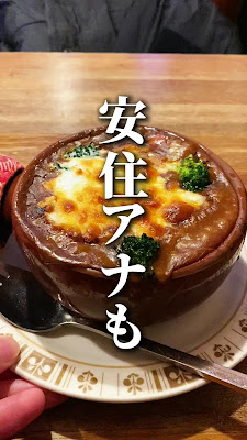 스톤 사진 2