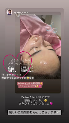 Luster 사진 3