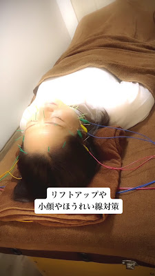 美容鍼灸LUCIAZ 【ルシアス】 사진 2