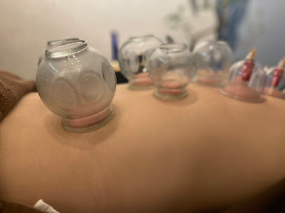 jeebu Shinkyu Acupuncture 사진 5