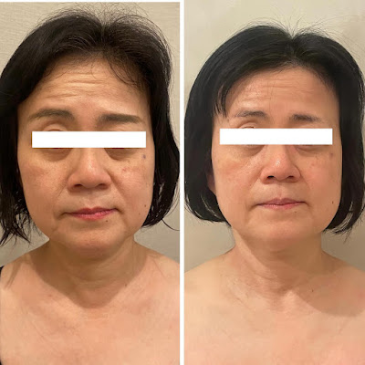 Dr.Body Crystal 사진 4
