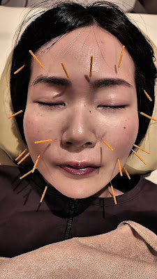 Japanese beauty acupuncture ＆ massage Zen&Glow 사진 2