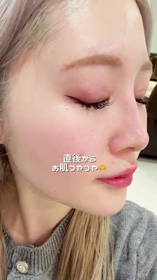 CareNa 梅田店【毛穴洗浄専門|医療提携サロン】 사진 2