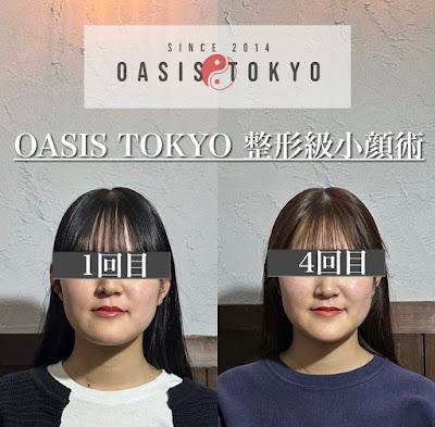 OASISTOKYO 心斎橋 사진 5