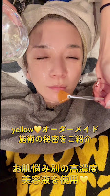 yellow.【都度払い脱毛・フェイシャルサロン】 사진 2