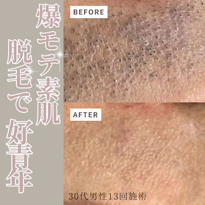 salon de CERM 사진 3