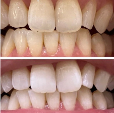 Whitening Salon Shiro 難波大国町店 사진 4