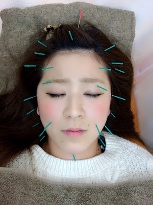Kanzaki Osteopathic/ Acupuncture Clinic 사진 3