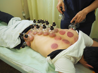 Miyashitashinkyu Acupuncture 사진 4