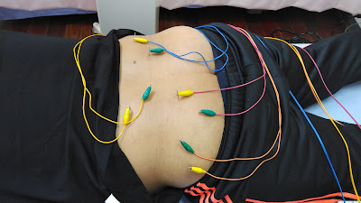 Tanimotoshinkyu Acupuncture 사진 3