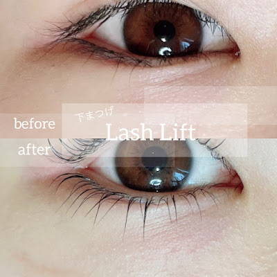 Loel eyedesign 사진 3