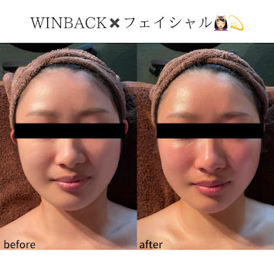 トータルビューティサロン美こと 사진 4