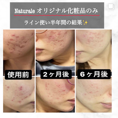 Naturale 사진 5