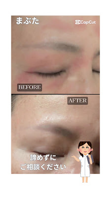 Relaxing facial treatment Kyotobigan 사진 2