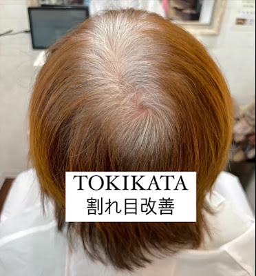 total beauty & health PUA MELIA 사진 4