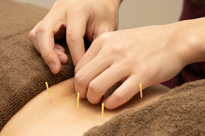 Kan Harikyuin Acupuncture 사진 5