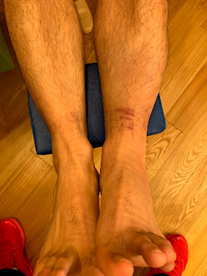 Yubiharishinkyu Acupuncture 사진 4