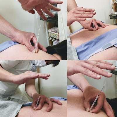☯kawashimashinkyu Acupuncture 사진 4