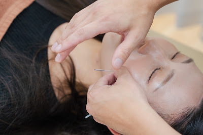 Harikuru (Haricle) Acupuncture 사진 4