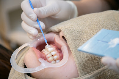 デンタルビューティサロン リノエル／Dental beauty salon Linoel 京都市 |ホワイトニングサロン 사진 3
