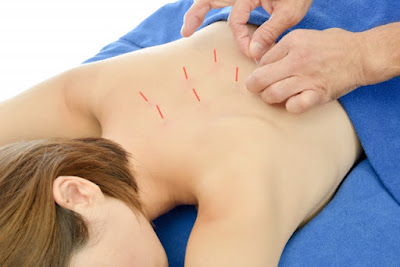 Goshinkyu Acupuncture 사진 4