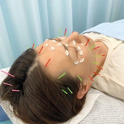 Goshinkyu Acupuncture 사진 2