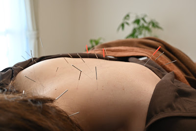Koen Acupuncture 사진 3