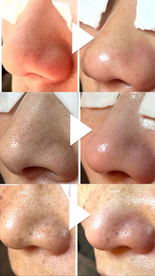 【毛穴とまつ毛の専門店】ラロリ Ｌａｌｏｌｉ 사진 2