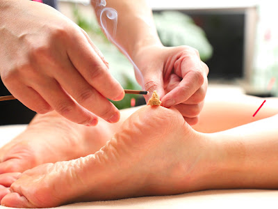 Acupuncture and Chiropractic Salon Tsukiumi 사진 4