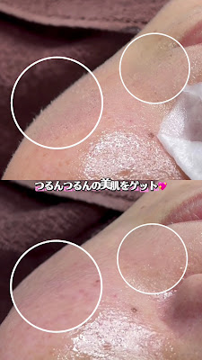 毛穴ケアサロン そらな 사진 2