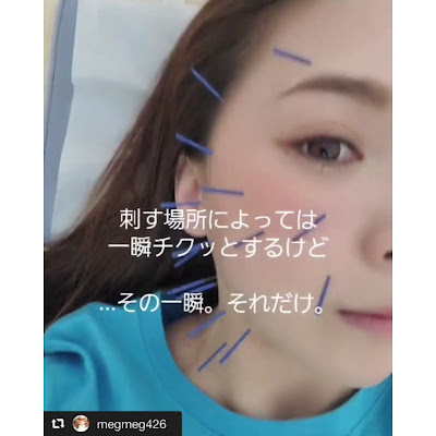 Sumireshinkyu Acupuncture 사진 2