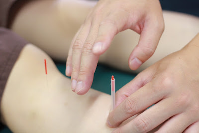 Karasumaoikemimoza Acupuncture 사진 4
