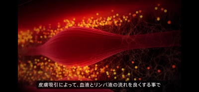 烏丸御池｜中村針灸整骨院【ぎっくり腰/坐骨神経痛/筋膜リリース】 사진 2