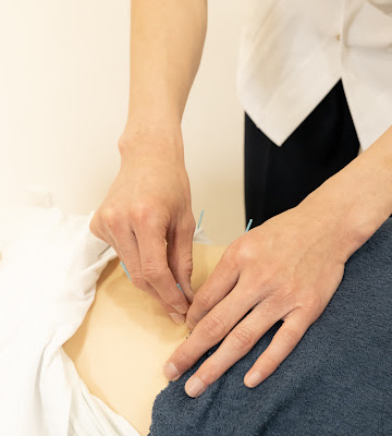 Onishishinkyu Acupuncture 사진 4