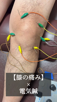 鍼灸・整骨 kiwami 사진 2